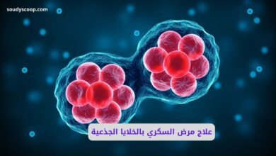 علاج مرض السكري بالخلايا الجذعية